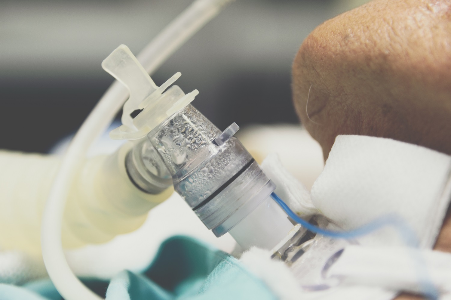 Critically Ill Airway August 2018 Alfred Health - 