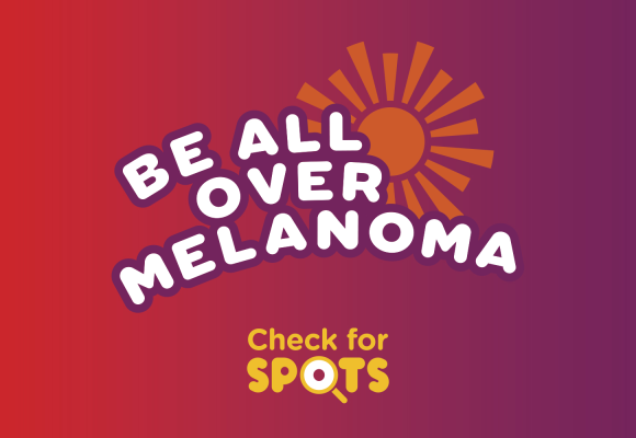 Australians urged to ‘be all over melanoma’ on 30 January article image